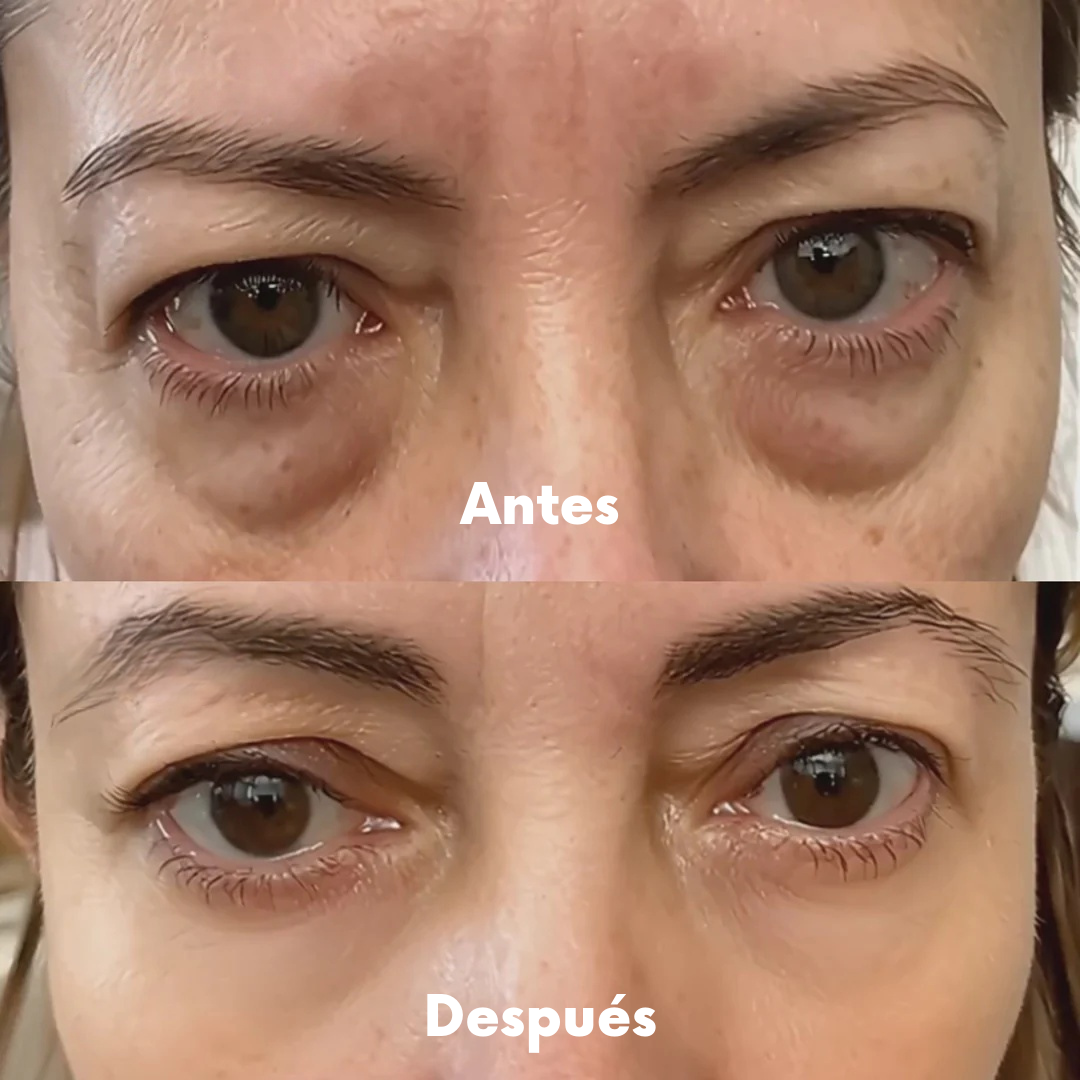 EyeVive-Masajeador Ocular 3D con Luz Roja y Microcorriente